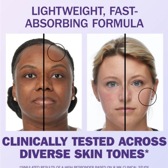 Olay Super Serum 5 in 1 Benefit Face Serum - 1 fl oz - Picture 7 of 9